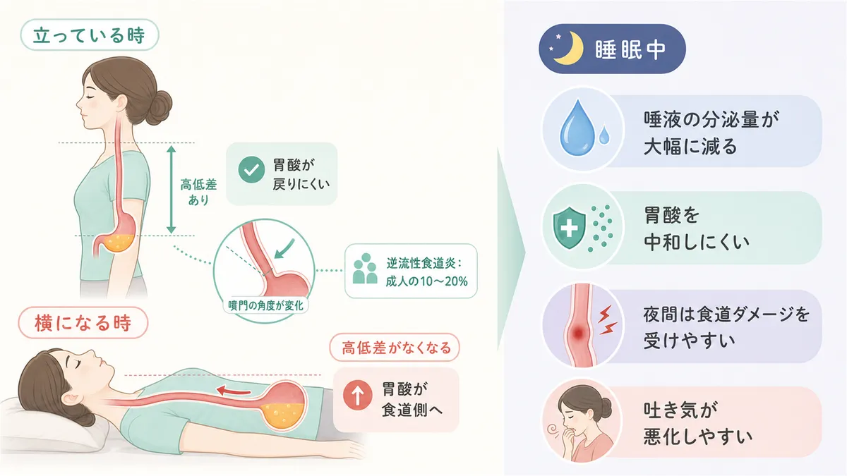 胃と食道の位置関係の変化や、睡眠中は体の防御力が下がることを解説します。